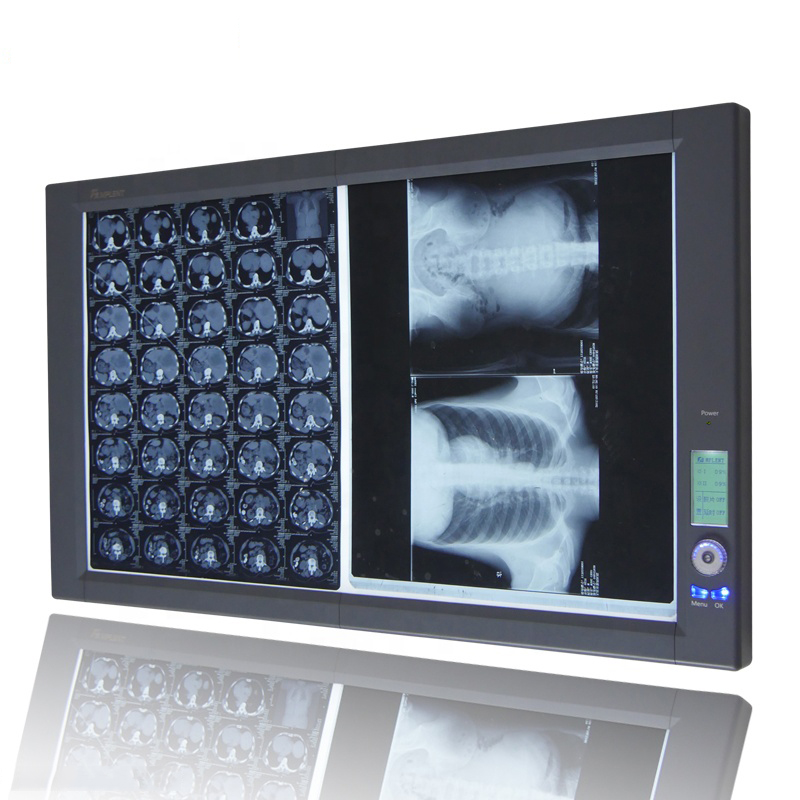 Caja de visualización de película de rayos X LED (2A)