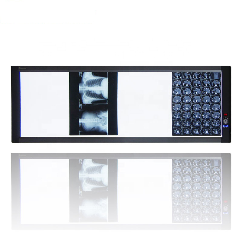 Cuadro de visualización de película de rayos X LED (4B)